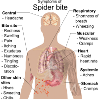 symptoms of a spider bite infographic